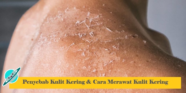 Penyebab Kulit Kering & Cara Merawat Kulit Kering